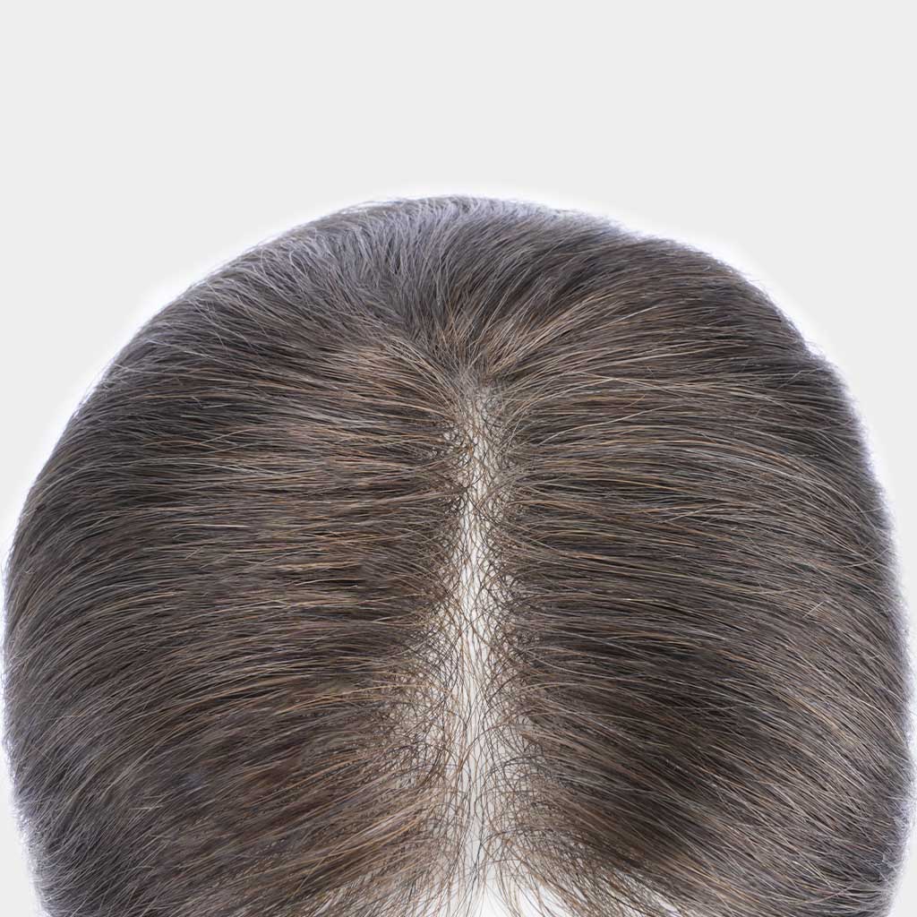 HS1V-TOP-Thin-Skin-Hair-System-for-Crown-Area-V-looped-Human-Hair-2